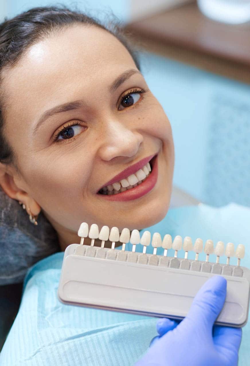 dental bonding shades selection